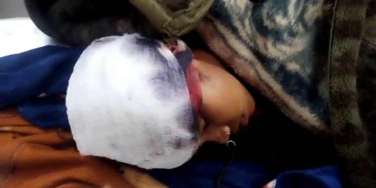 गौरेला-पेंड्रा-मरवाही: घर में घुसकर 16 वर्षीय किशोरी पर टंगिया से जानलेवा हमला, गंभीर हालत में जिला अस्पताल रेफर; ग्रामीणों में दहशत गौरेला-पेंड्रा-मरवाही: घर में घुसकर 16 वर्षीय किशोरी पर टंगिया से जानलेवा हमला, गंभीर हालत में जिला अस्पताल रेफर; ग्रामीणों में दहशत