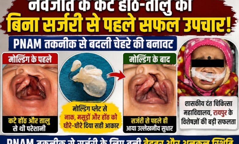 नवजात के कटे होंठ-तालु का बिना सर्जरी से पहले सफल उपचार, PNAM तकनीक ने बदली चेहरे की बनावट